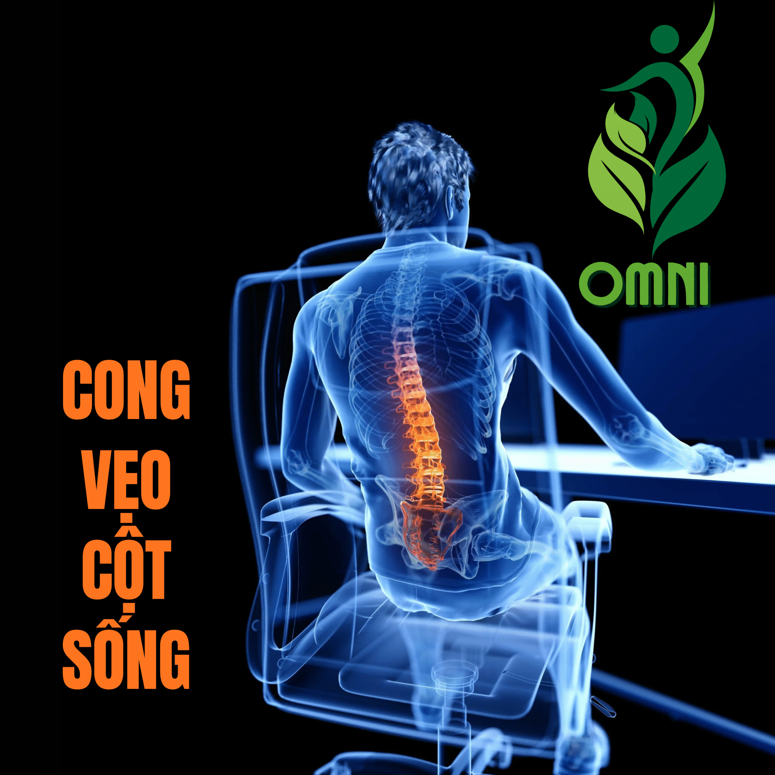 Trị liệu cong vẹo cột sống
