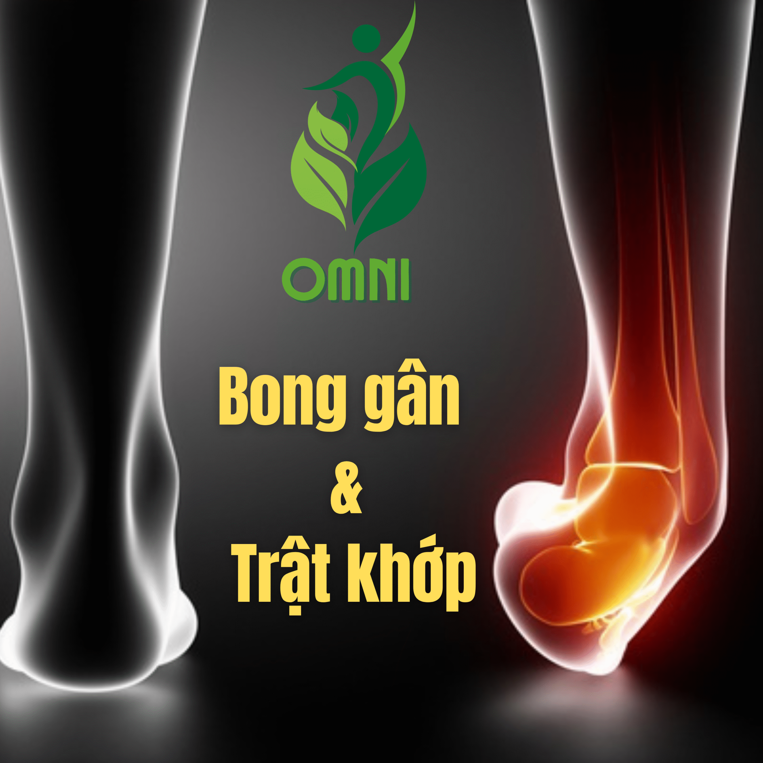 Trị liệu trật khớp và bong gân